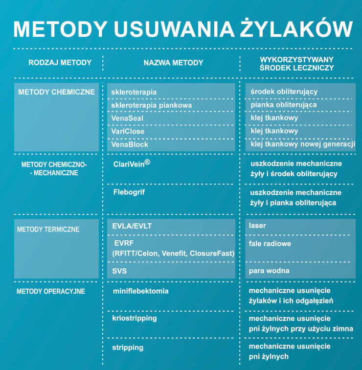 metody usuwania żylaków